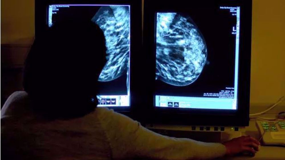 Poorer women in UK have sixth-highest cancer death rates in Europe: WHO 