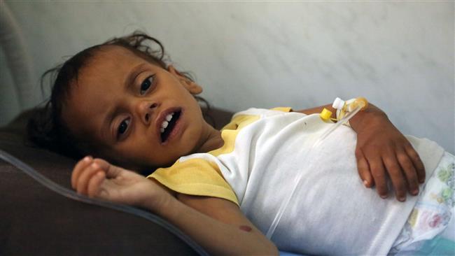 130 Yemeni children die per day: Charity group