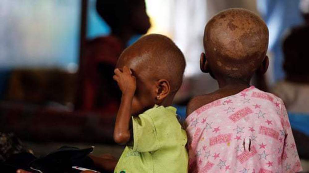 UN raises alarm about hunger, food insecurity in DR Congo