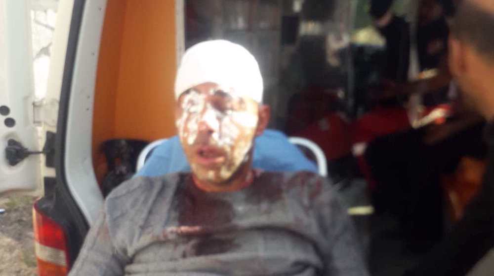 Palestinians injured, cars vandalized in yet another settlers’ attack 