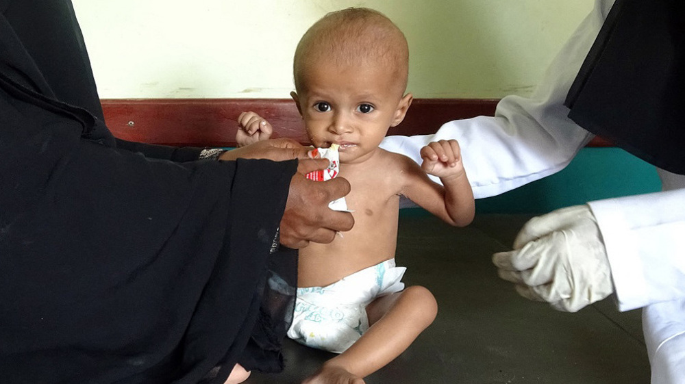 WHO: 75% of Yemen's children chronically malnourished