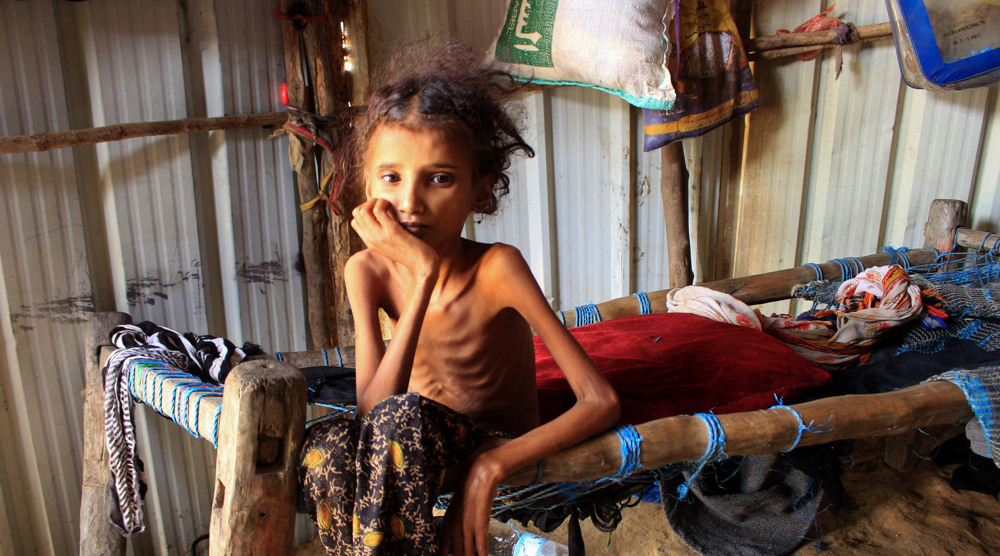 Yemen suffers the world's worst epidemic disaster