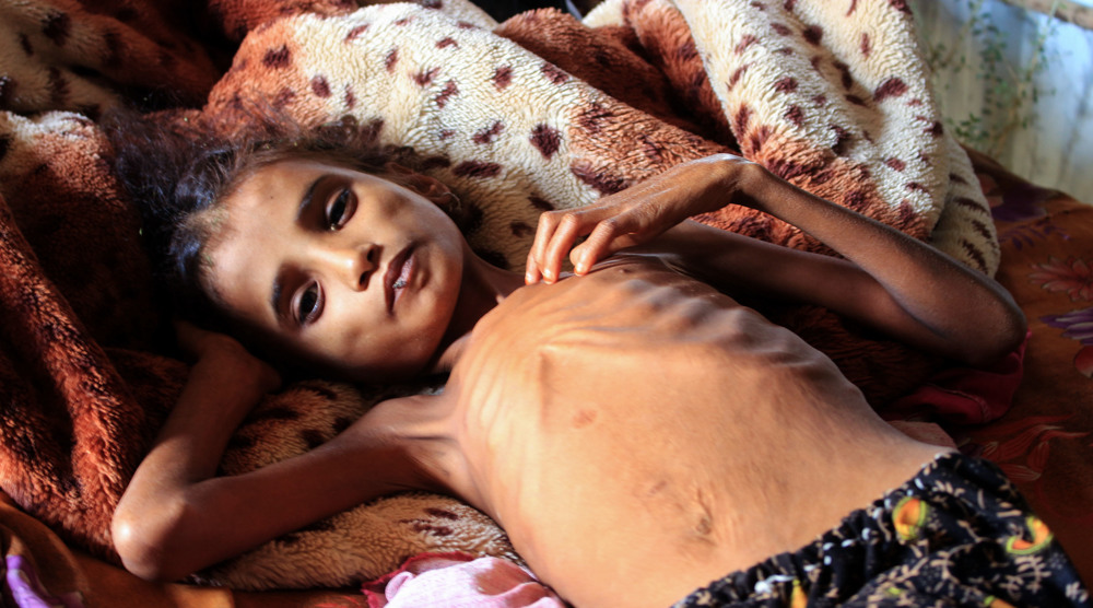 UN implores donors to prevent famine 'engulfing' Yemen