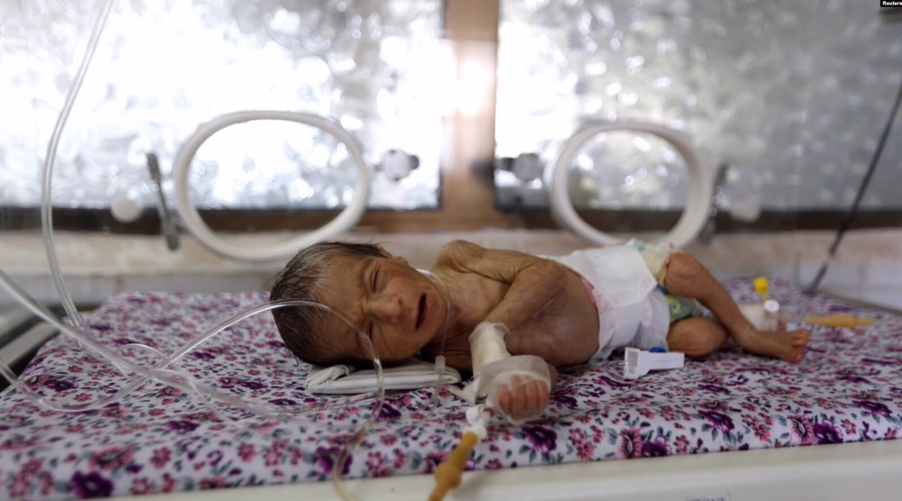 Over 80 Yemeni newborns die every day due to Saudi-led war: Ministry