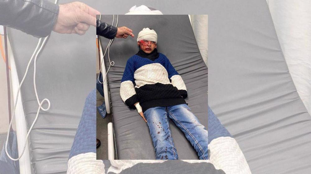 Israeli settlers beat up, injure Palestinian child in al-Khalil amid new round of raid