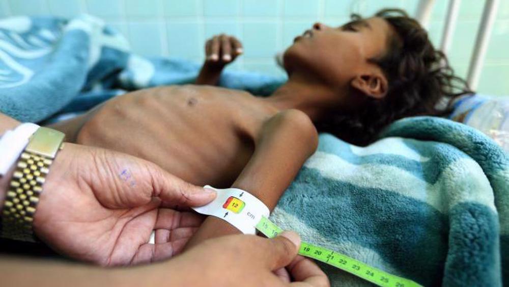 Yemen warns of attacks on ‘very sensitive targets’ in UAE over attempts to starve civilians