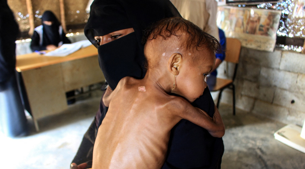 Yemeni FM says Saudis, allies committed ‘unprecedented war crimes’