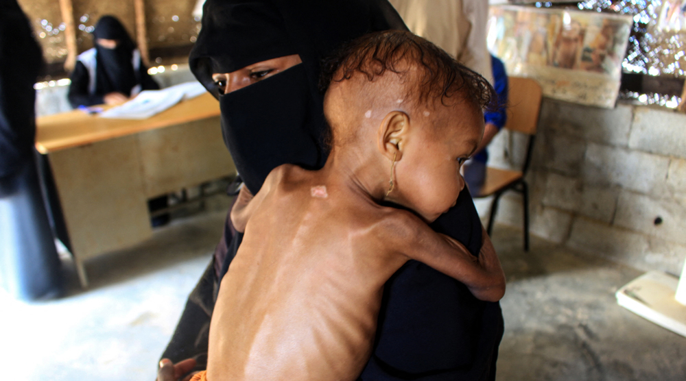 Yemen slams UN inaction on Saudi massacre of children