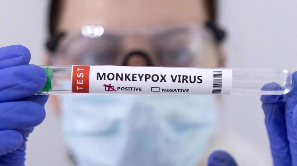 Spain reports Europe's first monkeypox-related death 