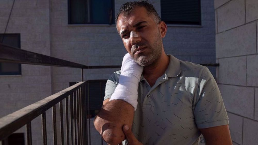 Palestinian man tells of trauma after Israeli officer kneeled on his neck