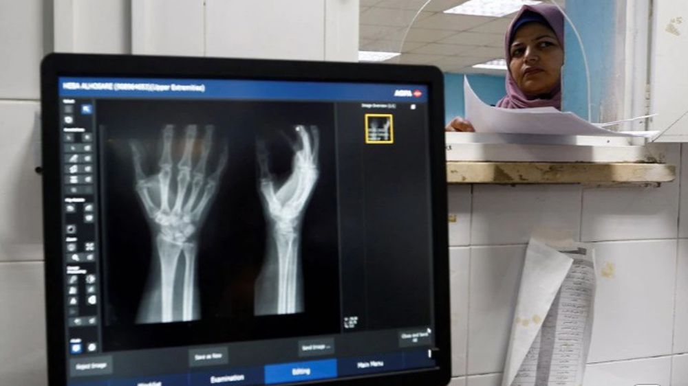 Israel preventing X-ray machines from entering Gaza: Health ministry