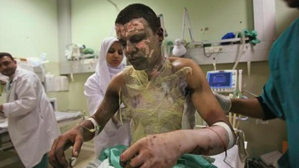MSF surgeon recounts Israel's phosphorus bomb attacks on civilians in Gaza