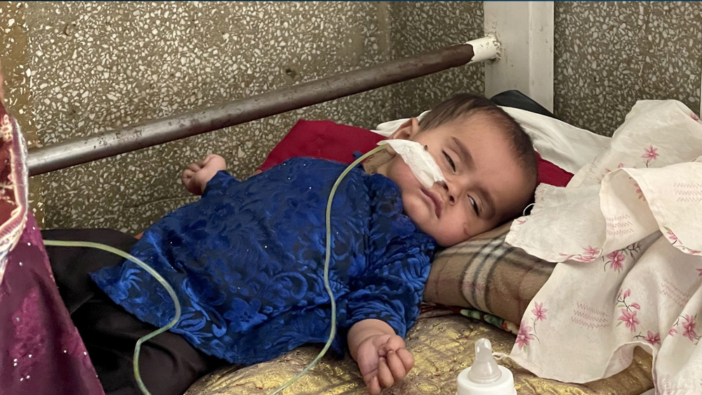 Malnutrition taking heavy toll on Afghan children