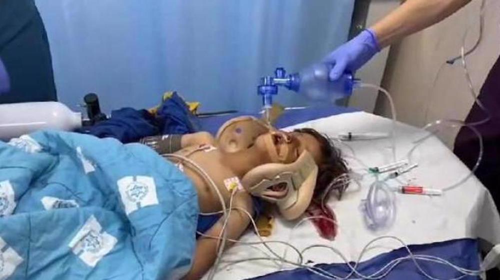 4-year-old Palestinian child in critical condition after run over by Israeli settler 