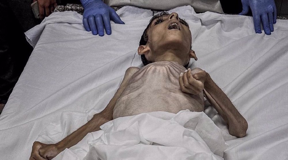Palestinian teen starves to death following Israeli siege of Gaza