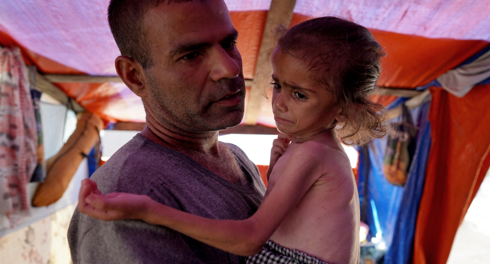 UNICEF: 90% of Gaza children suffer from severe food poverty
