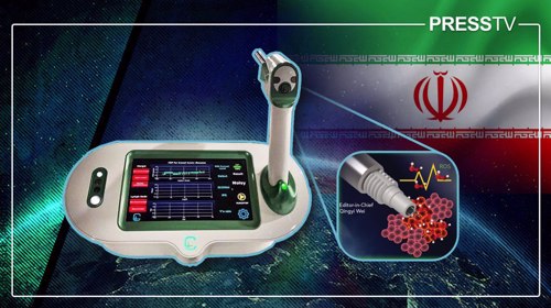 Explainer: 15 seconds that save lives: Inside Iran’s world-first cancer surgery breakthrough