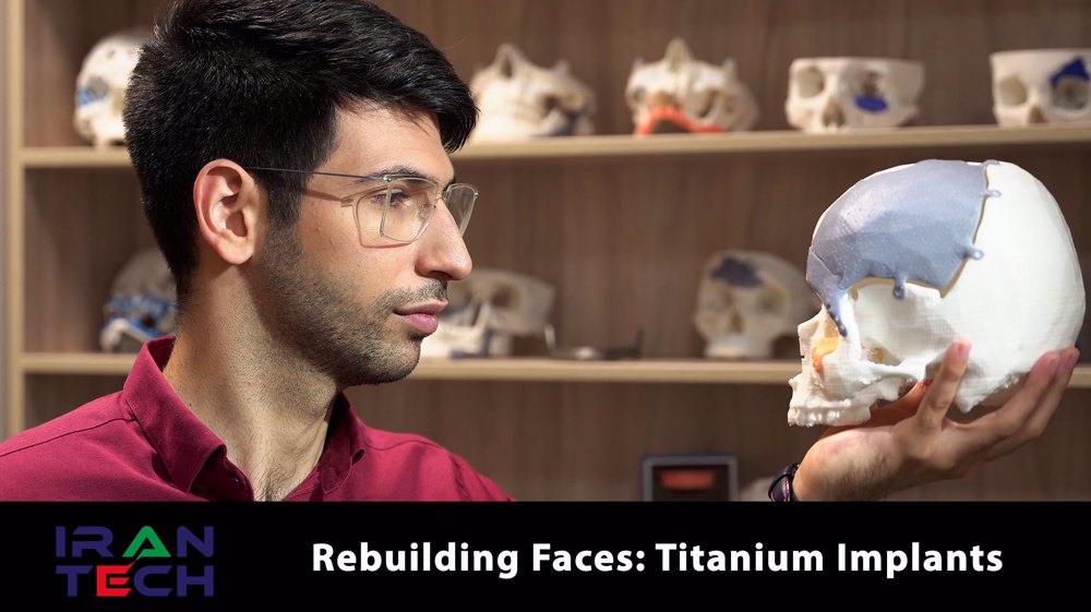 Rebuilding faces: Titanium implants