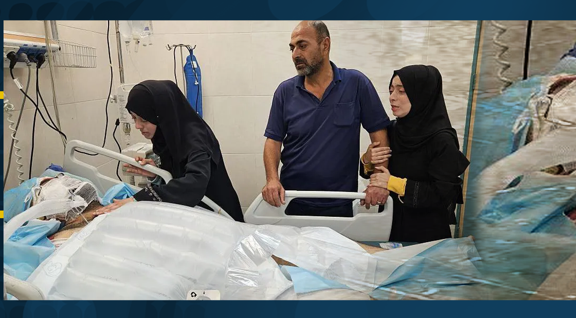 Ten Palestinian children burned by Israel