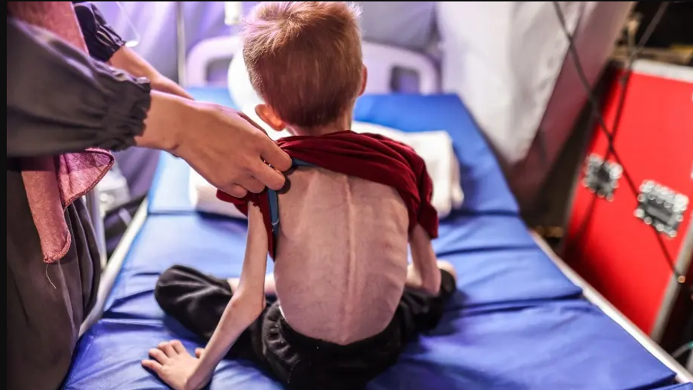 Gazans starving to death