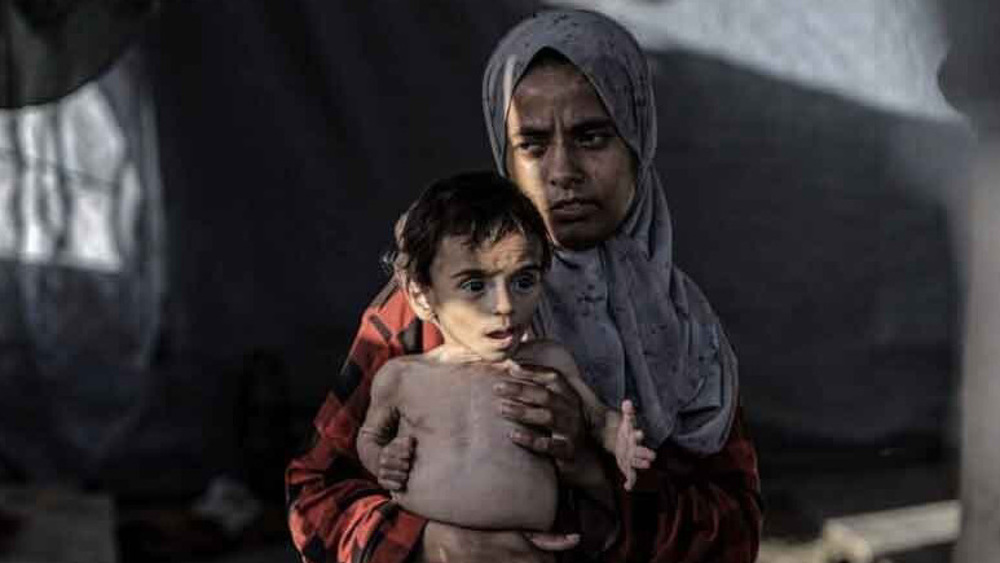 21 children die of hunger in Gaza amid Israel’s forced starvation policy 