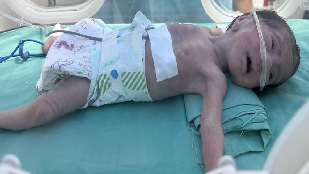 ‘Words don’t feed hungry children’: UN chief slams ‘lack of compassion’ for Gazans