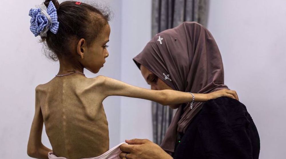 'Worst-case scenario famine' unfolding in Gaza: UN-backed experts 