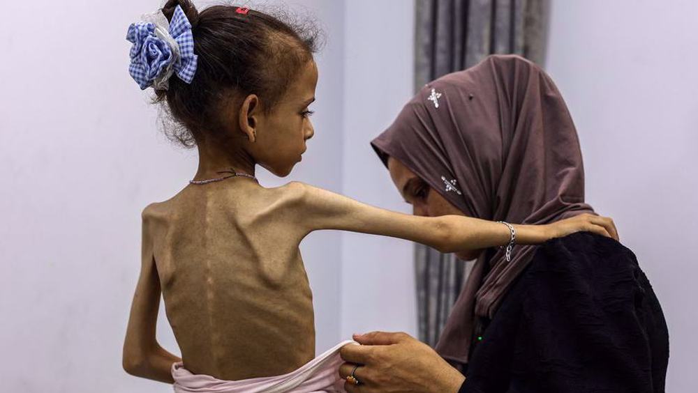 Gaza in ‘most dangerous stage of genocide’ as famine spreads: Hamas