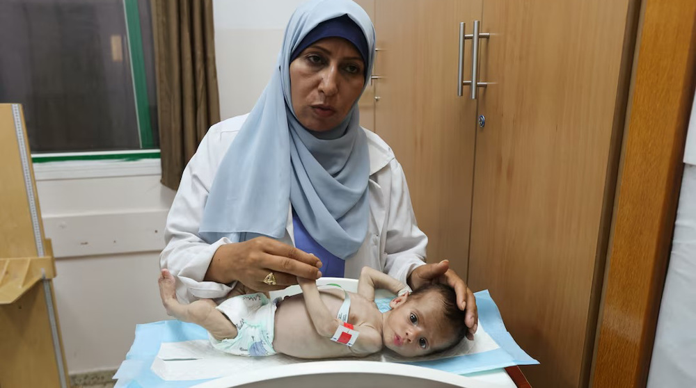 Seven more Palestinians die of starvation in Gaza, raising hunger-related death toll to 154
