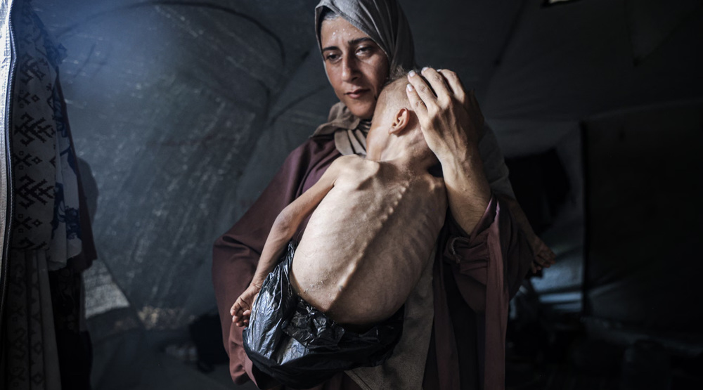 ‘No innocents in Gaza’: Israeli minister denies famine amid starvation deaths 