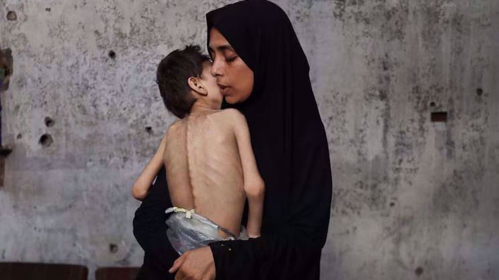 Gaza is facing famine, kids suffering from severe malnutrition: UNICEF official