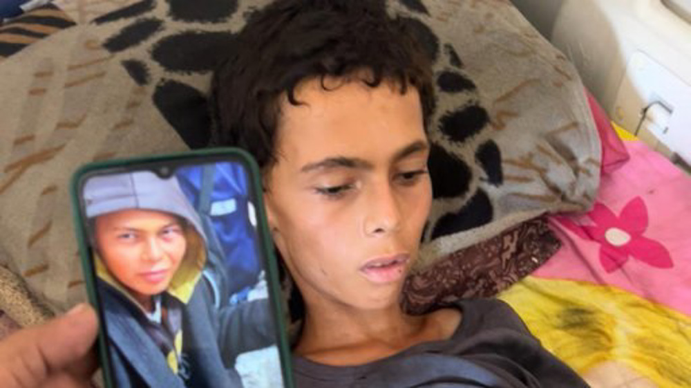 Gaza : sept autres Palestiniens morts de faim, dont un champion local