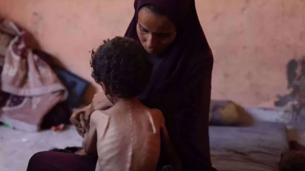La famine s'aggrave de manière délibérée à Gaza