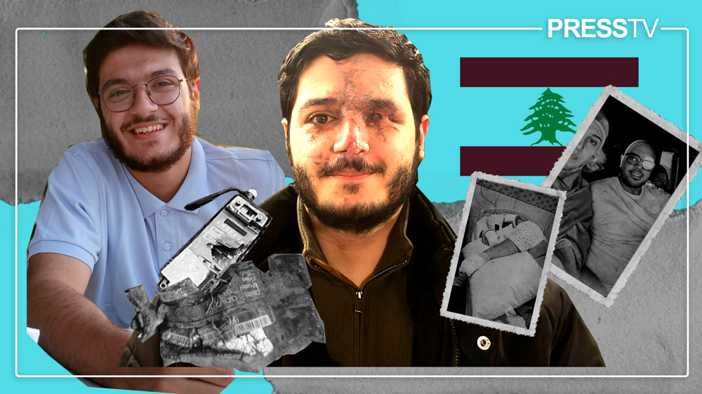 Trauma to strength: One year on, Lebanese pager attack victims reflect on life, loss, and resilience