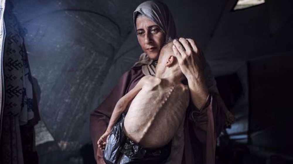 Six more die of starvation in Gaza amid ‘sharp rise’ in famine-related deaths 