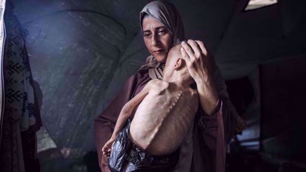 Six autres Palestiniens, dont un enfant, meurent de faim à Gaza