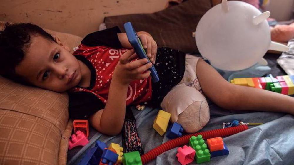 Génocide à Gaza: des milliers d’enfants amputés par les frappes israéliennes