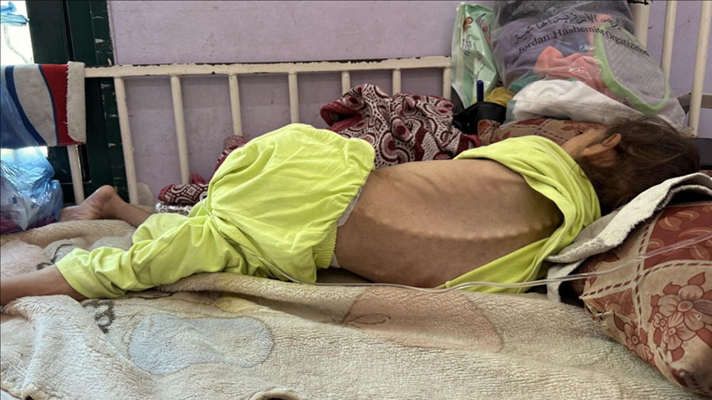 L’OMS appelle à un accès sûr et durable à l’aide alors que la famine s’aggrave à Gaza