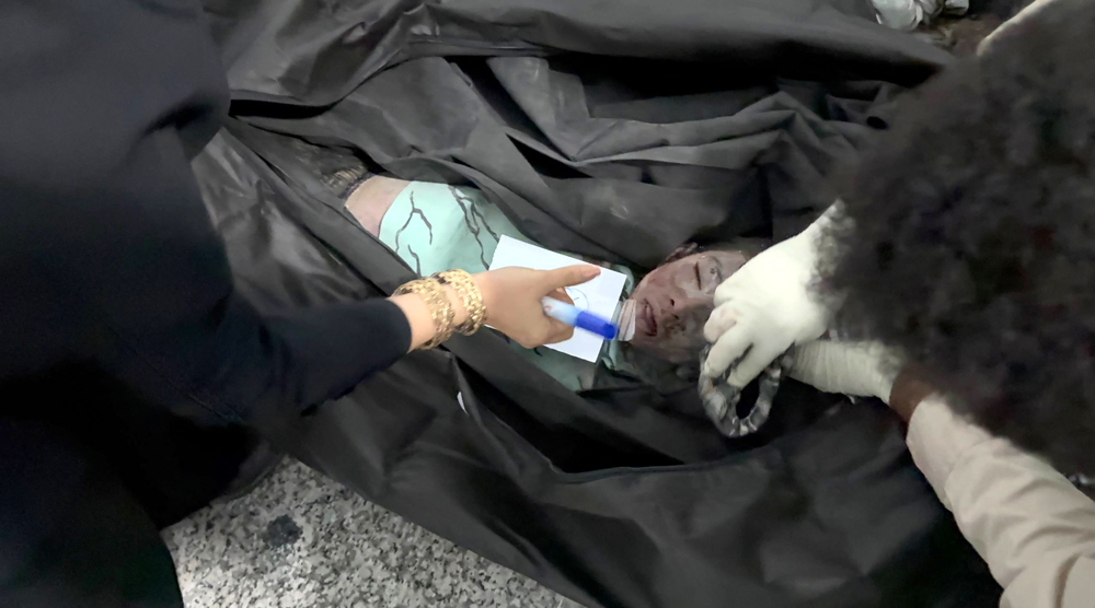 This picture shows of the body of a little girl killed in a missile strike on a girl's school in Min