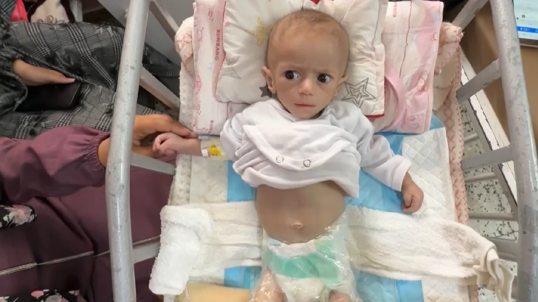 Hunger in the shadow of ceasefire: Gaza’s children fight malnourishment