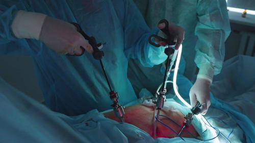 In a rare feat, 92-year-old woman in Iran had gallbladder removed without anesthesia