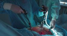 In a rare feat, 92-year-old woman in Iran had gallbladder removed without anesthesia