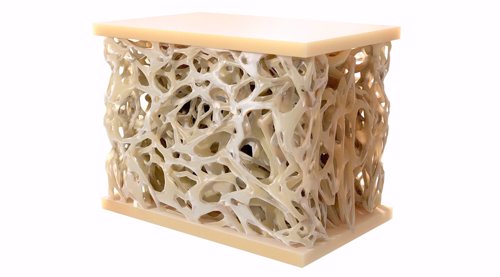 Iran develops next-generation nanotech bone graft for faster bone regeneration