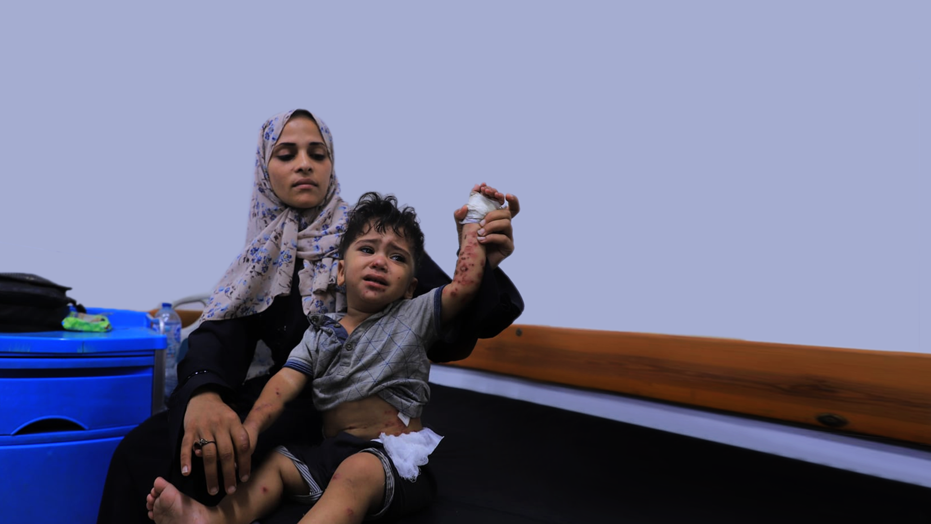 UN warns skin infections turning into a pandemic in Gaza