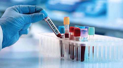 Iranian researchers develop blood test kit to help detect, monitor certain cancers without biopsy