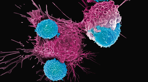 Advanced lymphoma treatment technology under development at Iran's Royan Institute