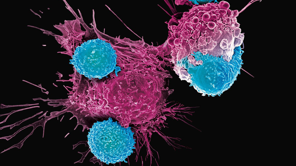 Iran: l'Institut Royan développe une technologie de pointe pour le traitement du lymphome