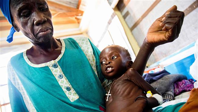 '1.4 million kids face famine in 4 countries'