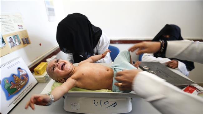 UN: 19 million Yemenis in need of relief aid