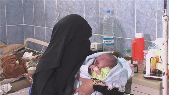 Deformed babies born out of Saudi war on Yemen